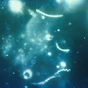 Darkfield micrograph of <i>Treponema pallidum</i>