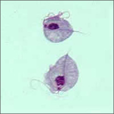 Two <i>Trichomonas vaginalis</i> parasites, magnified (seen under a microscope)