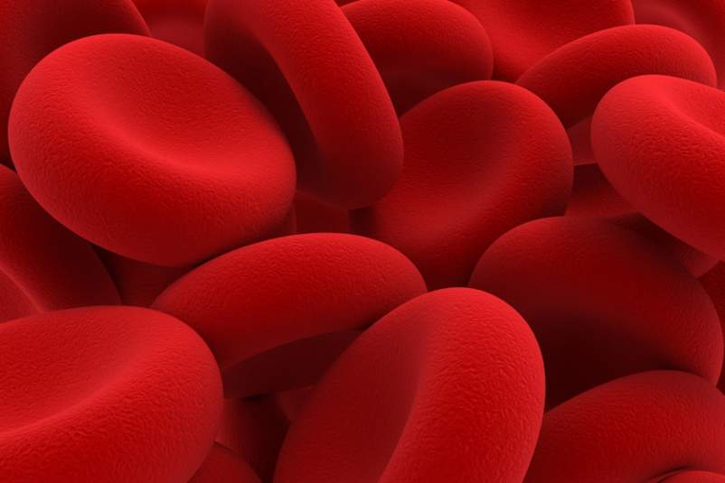 Women, Anemia and HIV/AIDS