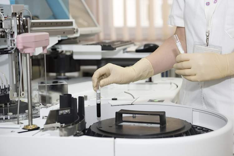 Understanding HIV-Related Lab Tests I: Complete Blood Count and Blood Chemistry