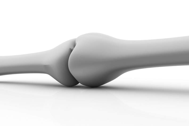 Bone Health and HIV/AIDS