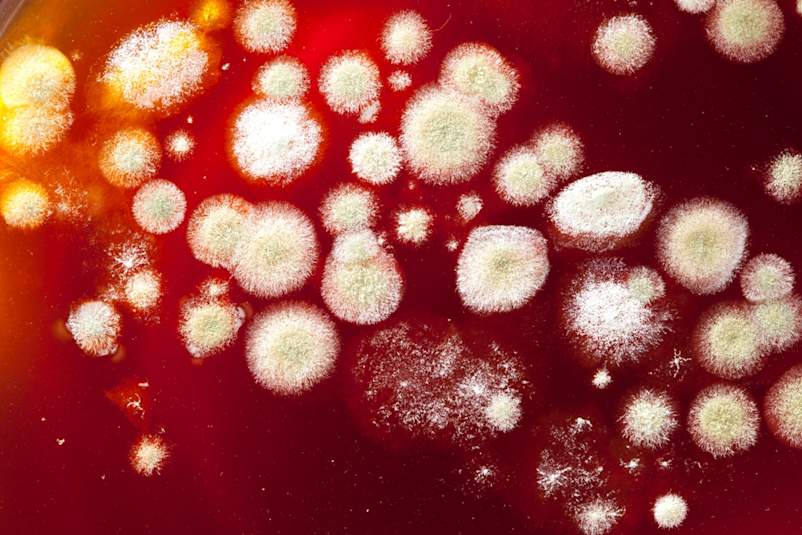 Fungal Infections