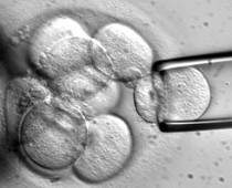 Stem cell transplant -- the cure for HIV? Photo: thinkprogress.org.