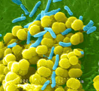 Sepsis Fact Sheet