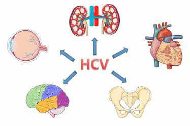 Figure 2. Non-AIDS Impact of HCV With HIV