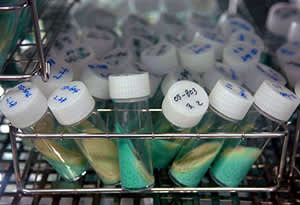 Sputum cultures from tuberculosis patients. Sputum often is used to detect and identify bacteria in the lungs. (Credit: NIAID)
