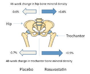 Impact of Rosuvastatin on Bone Mineral Density