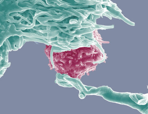 A plasmacytoid dendritic cell (blue) interacting with a T-cell (pink).