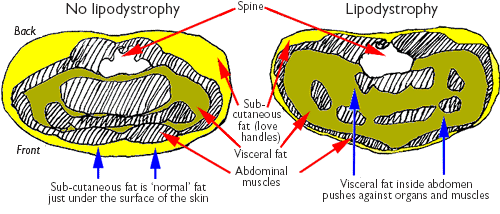 Figure 4: Illustration of MRI scans