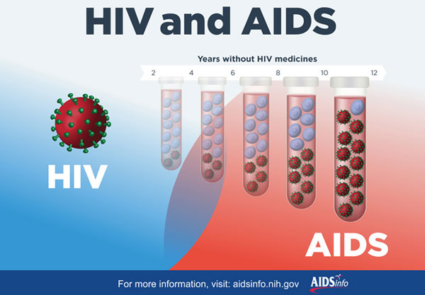 HIV and AIDS