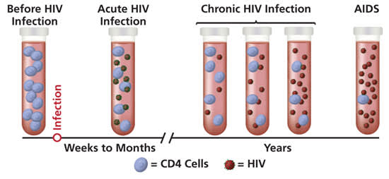 HIV Progression