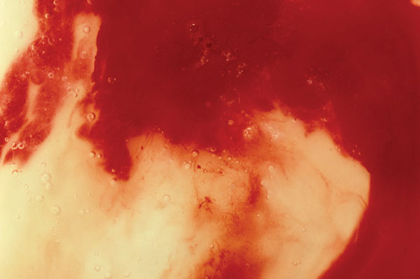 Blood and Semen III (1990); chromogenic color print, edition 1 of 4, 40 x 60 by Andres Serrano (Courtesy of the Alphawood Foundation)