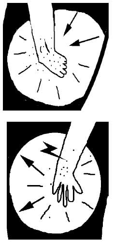 Peripheral Neuropathy