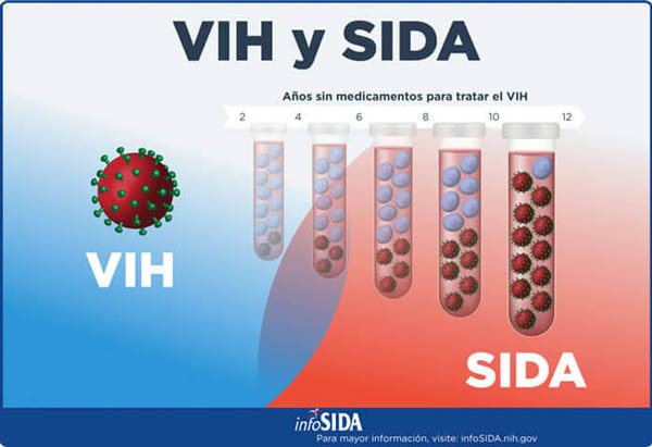 VIH y SIDA