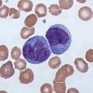monocytes