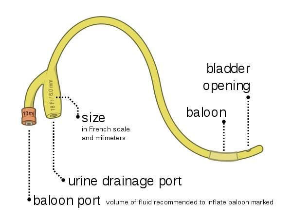 Foley catheter