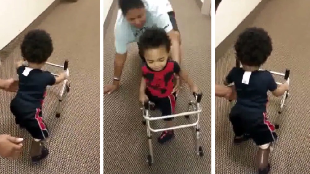 I Got It Inspiring Moment Two Year Old Double Amputee Walks For