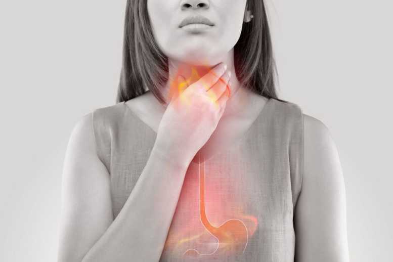 Reflux – symptoms, cause and treatment