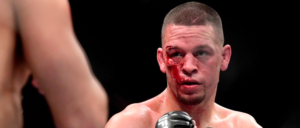 r-ufc-nate-diaz-bloody.jpg