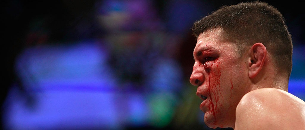 r-ufc-nick-diaz-bloody.jpg