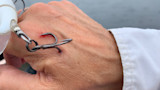 Treble fishing hook embedded in back of hand with small bleeding, white sleeve