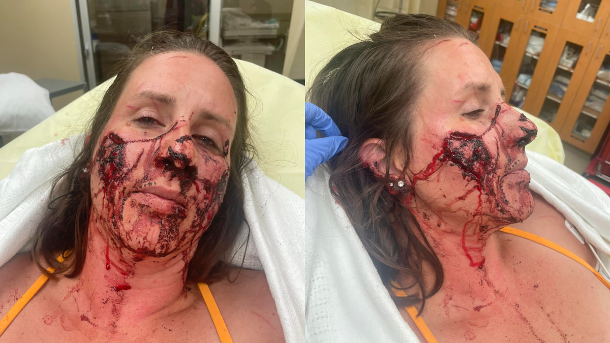 River Otter Mauls Three Women in Montana while Floating River