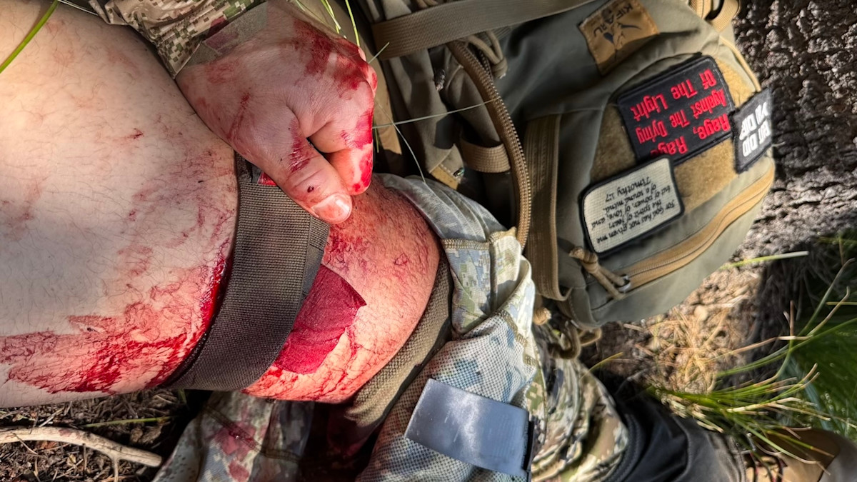 'My Pant Leg Was Turning Red': How an Elk Hunter Accidentally Stabbed Himself and Live to Tell the Tale