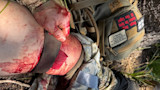 Bleeding thigh with tight strap and bloodied hand on strap; backpack patch reads "RAGE"