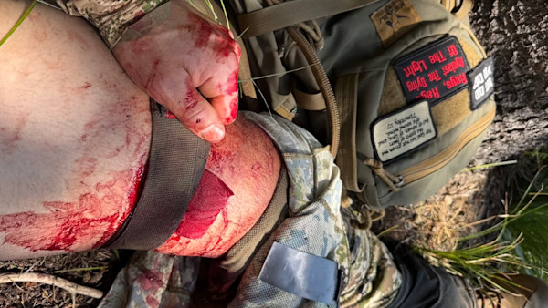 'My Pant Leg Was Turning Red': How an Elk Hunter Accidentally Stabbed Himself and Live to Tell the Tale