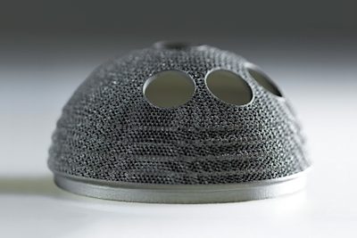 DMLS/SLM hip implant
