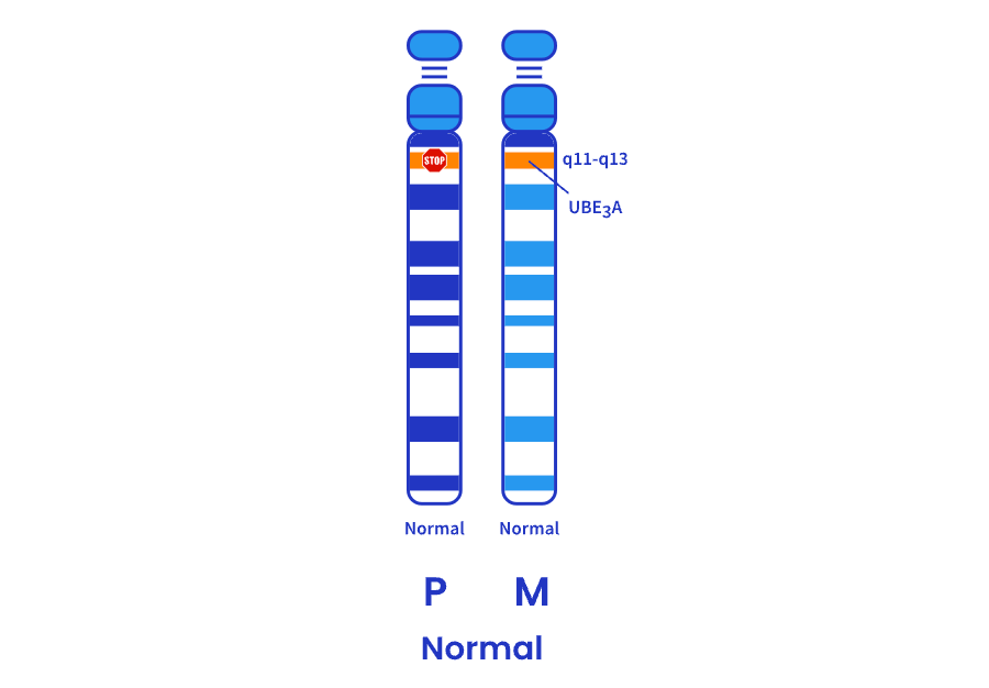Graphic: normal chromosome 15 illustration