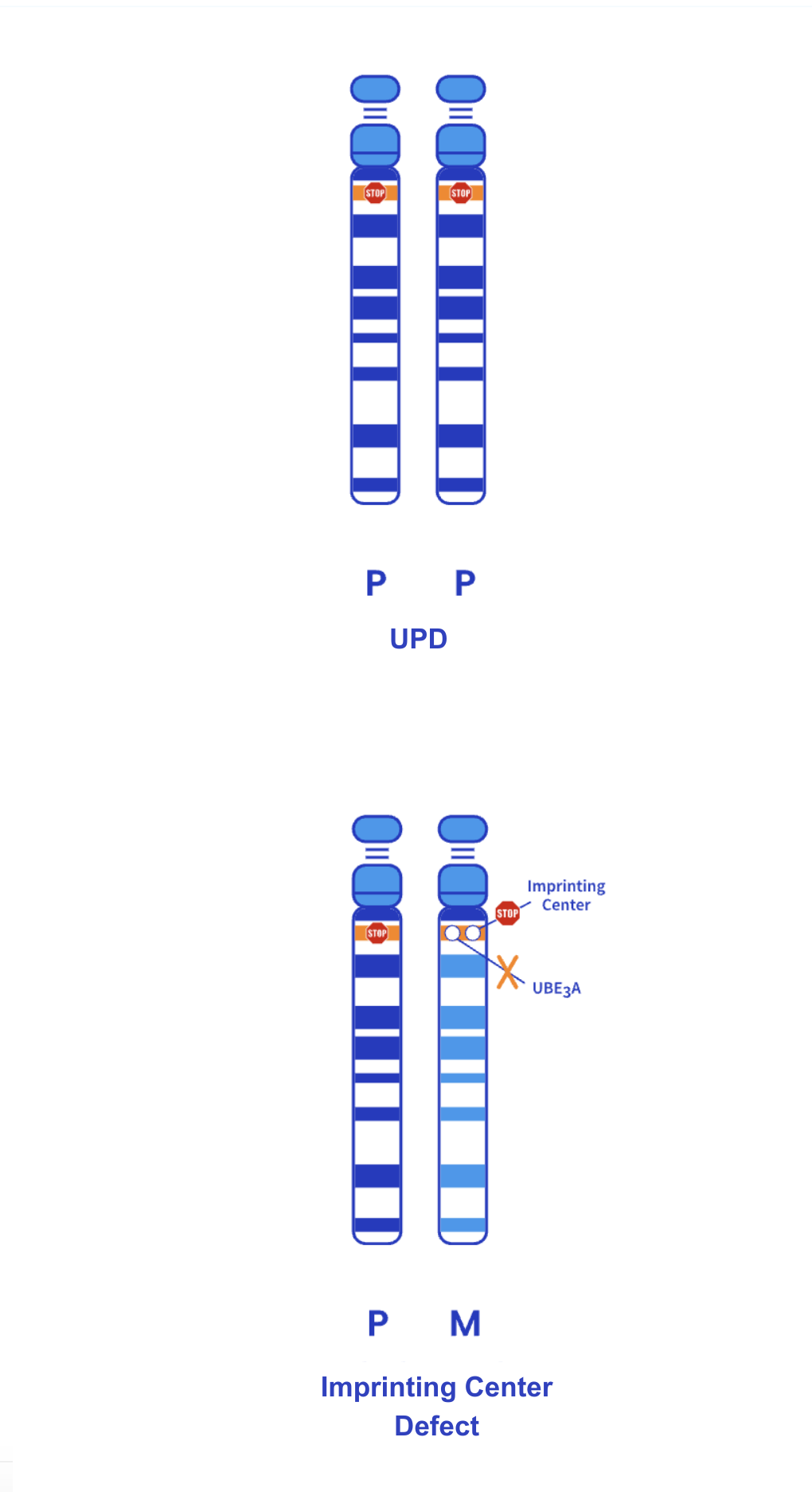 UPD/ICD genotype Illustration