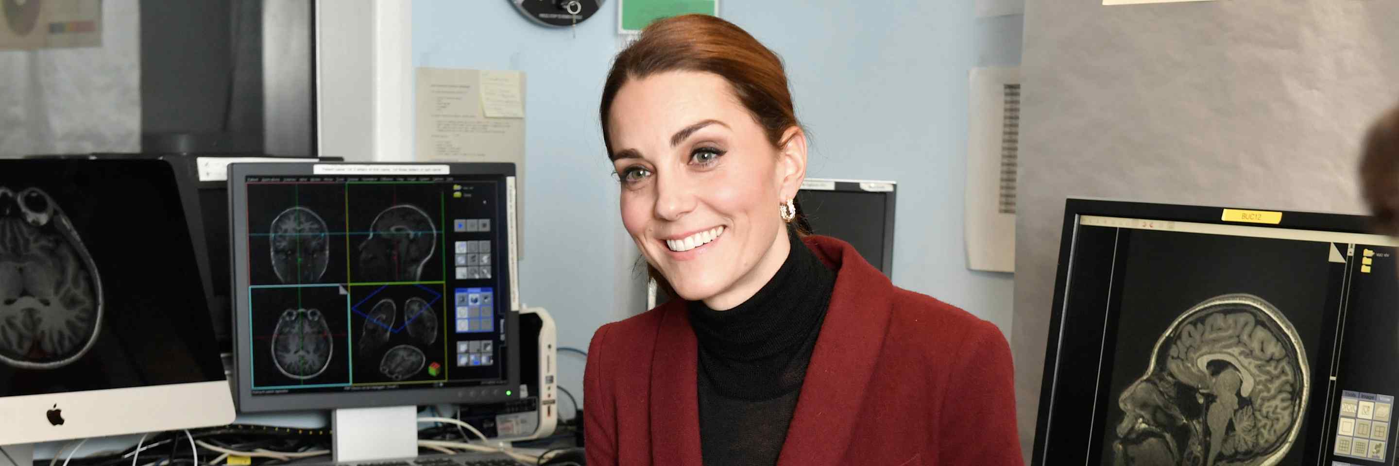 duchess-brain-scanner