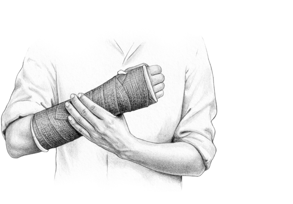 An illustration of a man holding a broken wrist in a cast.