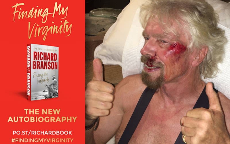 Richard Branson with an injured face and his autobiography