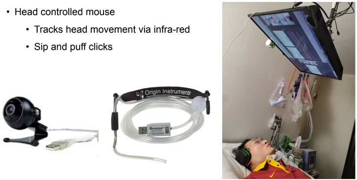 The assistive technology Chiou uses to access the computer from bed includes a head controlled mouse using an infra-red camera to track head movements and a tube that senses sips and puffs for mouse clicks. A monitor is mounted from the ceiling above him.