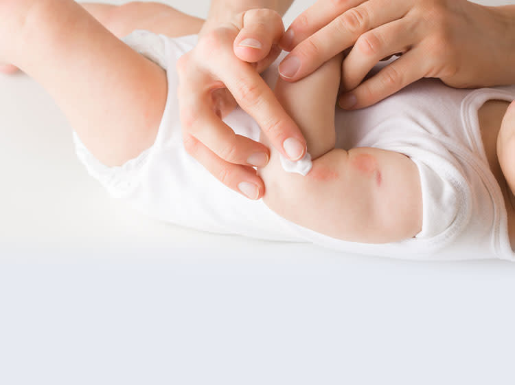 Eczema looks different in everyone, but there are a few symptoms you can look out for on your child’s skin.