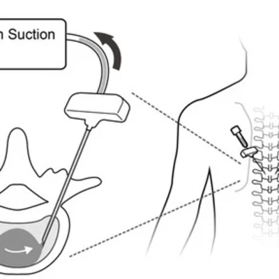 多項政府基金助力,iMET 定位裝置成功推進