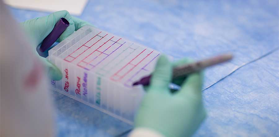 close up of scientist labeling tray with marker