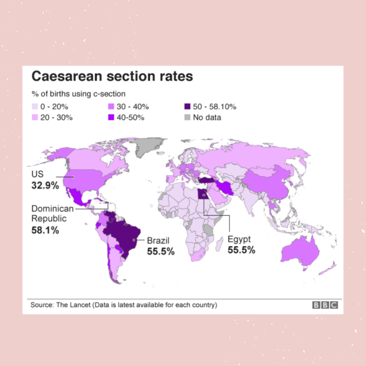 C section rates