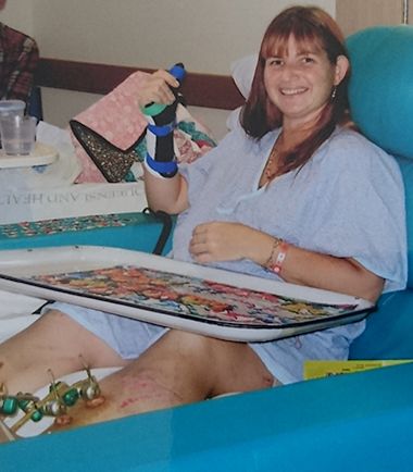 Mary recovering after her accident Shine Lawyers | Mary recovering after her accident