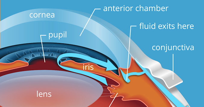 Glaucoma and eye anatomy