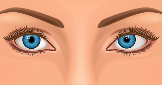 illustration of a person with strabismus