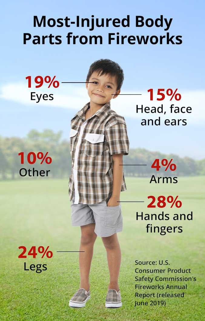 Most-injured body parts from fireworks