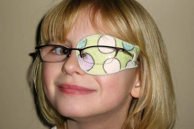 Eye patching for lazy eye