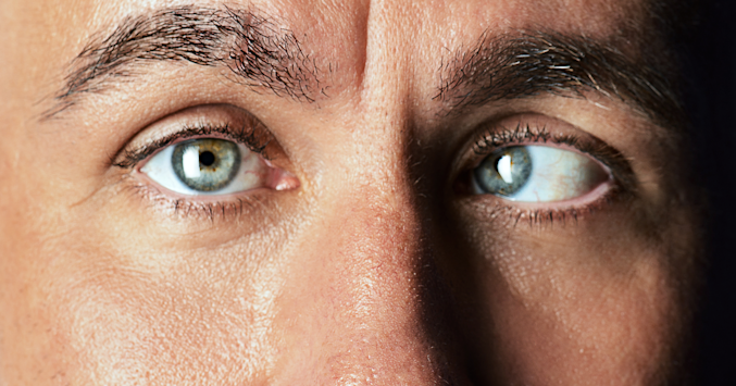 strabismus