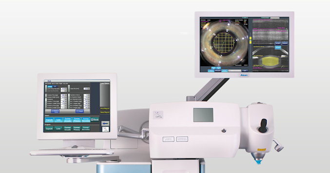 laser cataract surgery equipment