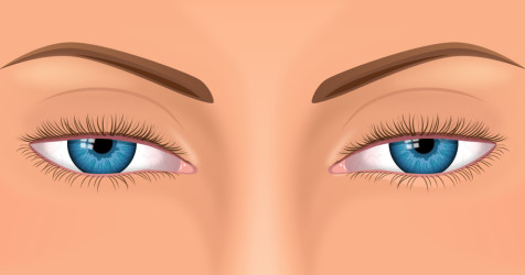 Droopy eyes