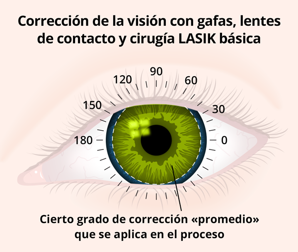 Corrección de la visión proporcionada por gafas, lentes de contacto y cirugía LASIK básica