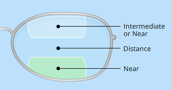 Lentes trifocales Doble D